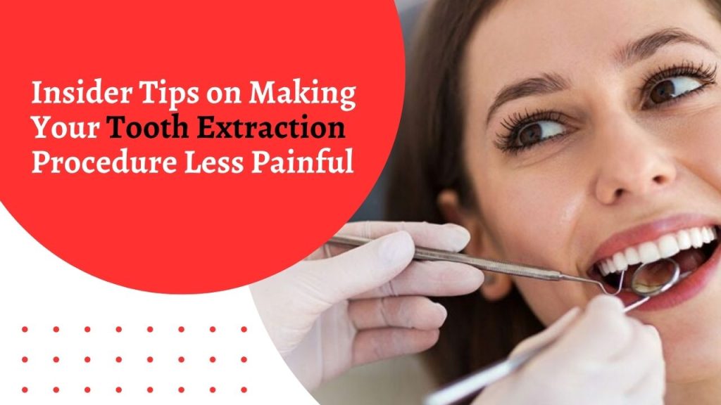 Insider-Tips-on-Making-Your-Tooth-Extraction-Procedure-Less-Painful