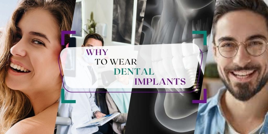 WHY WEAR DENTAL IMPLANTS